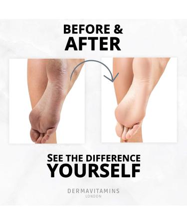 Dermavitamins Advanced Foot Mask Bag Repair Dry Feet (Pack of 3) | Intensive Hydration & Softening Treatment for Soft Healthy Feet - Buy Internationally - Buy Online on SooperMarket.com