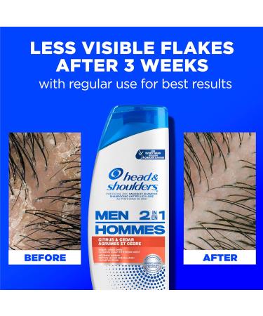 Head and Shoulders Mens 2 in 1 Dandruff Shampoo and Conditioner Anti-Dandruff Treatment Citrus & Cedar for Daily Use Paraben Free 370 mL (Packaging May Vary) Citrus + Cedar - Buy Online on SooperMarket.com