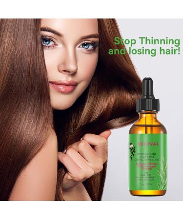 Rosemary Hair Growth Oil & Serum - Dry Scalp Treatment for Women | Hair Thickening & Essential Oil (2OZ) - Boost Hair Growth & Combat Hair Loss - Buy Online on SooperMarket.com