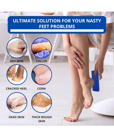 Love Natural Pumice Stone for Feet - 2-in-1 Exfoliating Scrubber for Dead Skin & Callus Removal - Professional Foot Care Rock (Blue - Buy Online on SooperMarket.com