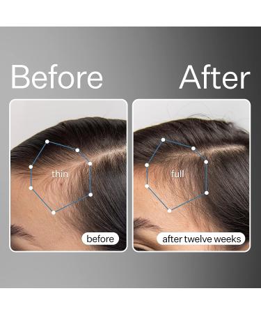 Act+Acre Apple Stem Cell Scalp Serum - Promotes Growth, Lessens Hair Loss, Soothes & Hydrates - Sulphate & Paraben Free - With Aloe Vera - Buy Online on SooperMarket.com