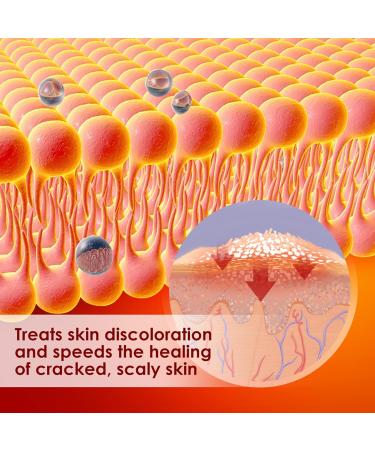 Irritated Skin Relief Cream - 20g Itching Cream for Health Care - Buy Online on SooperMarket.com