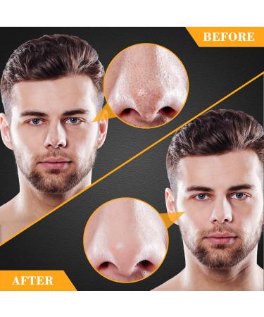 Charcoal Blackhead Pore Strips 33 pcs - Deep Cleansing Peel Off Strips for Men - Remove Blackheads and Face Oil - Nose and Facial Blackhead Remover - Buy Online on SooperMarket.com
