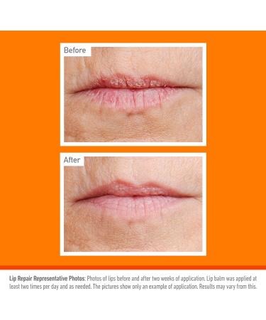 O'Keeffe's Lip Repair and Protect SPF15 4.2g - Hydrating Lip Balm with Sun Protection - Buy Online on SooperMarket.com