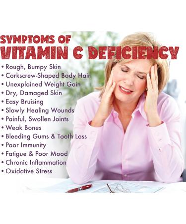 Promise Vitamin C - High Potency 1000mg 180 Capsules- High Immunity Support Healthy Bones Collagen Formation Body Tissue Repair Delayed Release for No Upset Stomach Made in Canada - Buy Online on SooperMarket.com