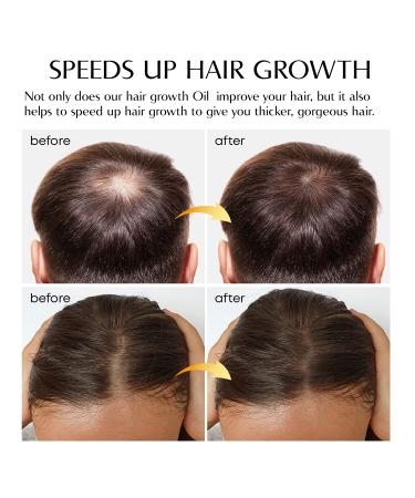 Ginger Hair Growth Serum | Prevent Hair Loss, Promote Thicker & Longer Hair | 1.7 Oz Bottle - Buy Online on SooperMarket.com