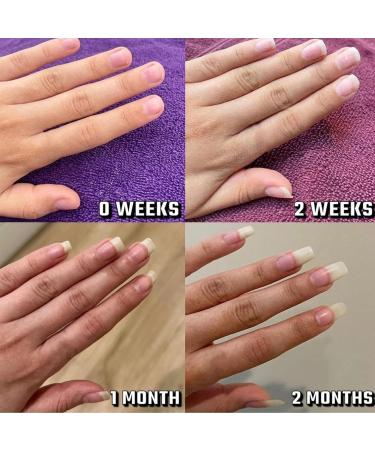 Radiant Nail Growth Oil - Strengthening & Moisturizing Serum | 3PCs for Healthier Nails - Buy Online on SooperMarket.com