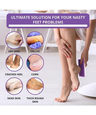Purple Love Natural Pumice Stone - Professional Exfoliating Rock for Feet, Hands & Body - Dead Skin & Callus Removal - 2-in-1 Scrubber - Buy Online on SooperMarket.com