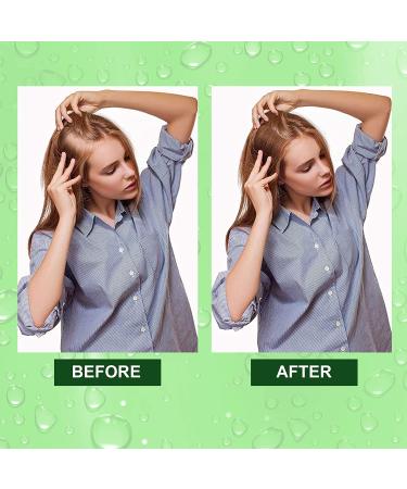 Rosemary Oil for Hair Growth & Skin Care - Stimulates Growth, Improves Scalp Health, 2.02 Fl Oz - Buy Online on SooperMarket.com