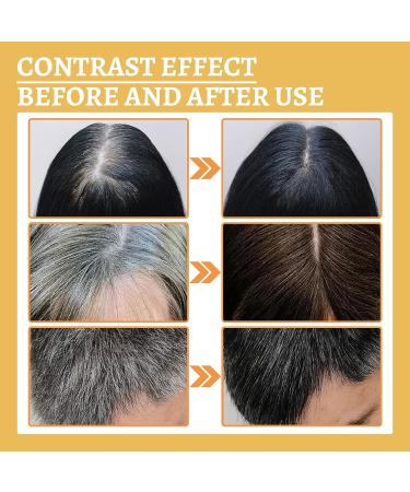 VisTapex DARKA Anti-Greying Hair Serum - Ganoderma Nutrient for Healthier, Thicker Hair (3Pcs) - Buy Online on SooperMarket.com