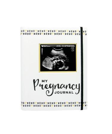 Pearhead My Pregnancy Journal, Pregnancy Keepsake Book, Pregnancy Milestone Memories, Photo Album, Gender Neutral for Baby Girl or Baby Boy, 1 Count (Pack of 1) black and white