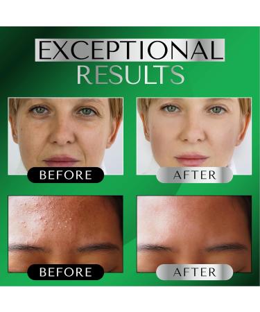 DERMAWORKS Retinol Serum with Vitamin E & Hyaluronic Acid - Anti-Aging Collagen Serum for Acne Treatment & Hydration - Buy Online on SooperMarket.com