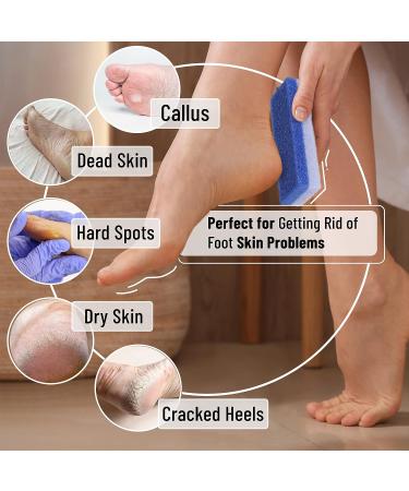 Slick Pumice Stone for Feet Callus Remover - 4 Pack, 2 Colors | Foot Scrub for Pedicure and Dead Skin Removal - Buy Online on SooperMarket.com