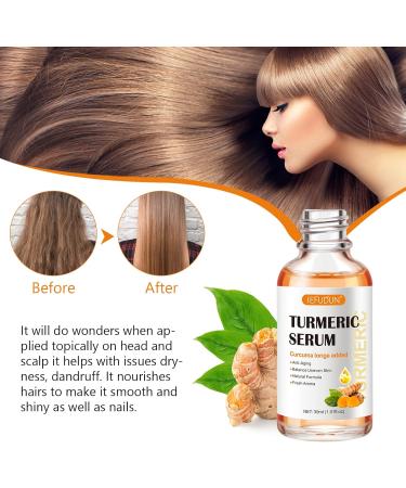 Turmeric Serum for Dark Spots Removal Turmeric Dark Spot Corrector Serum for Face & Body Turmeric Oil Age Spot Corrector Skin Care Moisturizing Serum - Buy Online on SooperMarket.com