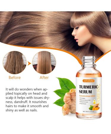 Turmeric Dark Spot Corrector Serum 2 PCS - Natural Facial Serum for Hyperpigmentation, Age & Sun Spots - Moisturizing Essence for Women & Men - 1Fl Oz (Pack of 2) - Buy Online on SooperMarket.com
