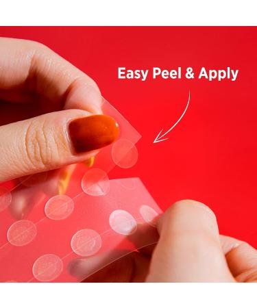 FD Registered Acne Patches | SOOAE Tea Tree Clear Dot - Medical Grade Hydrocolloid Spot Treatment for Fast Healing & Blemish Control (30 Dots - Buy Online on SooperMarket.com