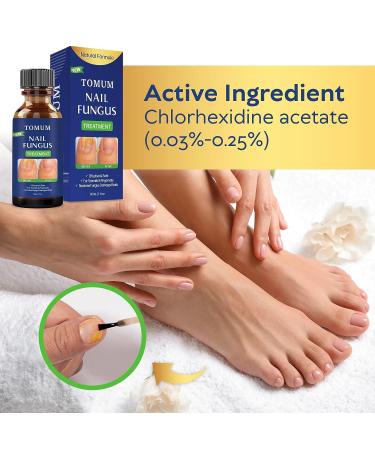 Extra Strength Toe Nail Fungus Treatment for Healthy Nails - Fingernail and Toenail Repair Solution - Buy Online on SooperMarket.com