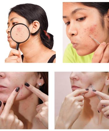 SAVBIN 7-Piece Blackhead Extraction Kit for Nose & Face - Professional Comedone & Pimple Remover Tool Set - Buy Online on SooperMarket.com