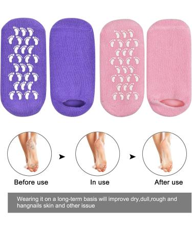 Moisturizing Gel Socks (2 Pairs) with Vitamin & Oil Infusion | Hydrating Moisture Socks for Dry Skin Repair - Purple & Pink - Buy Online on SooperMarket.com