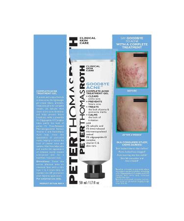 Peter Thomas Roth Acne Treatment Gel | Clear, Prevent, Treat, and Calm Acne | Post-Acne Mark Treatment - Buy Online on SooperMarket.com