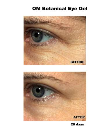 Organic Peptide Eye Cream with Vitamin C, Argan Oil & Cucumber | Rapid Wrinkle Repair Gel for Fine Lines, Under Eye Bags & Dark Circles | All Natural Day & Night Treatment - Buy Online on SooperMarket.com