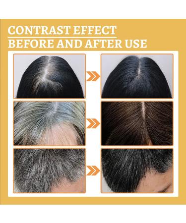DARKA Pro Anti-Greying Hair Serum - Natural Hair Darkening Treatment for Youthful Appearance (3 Pcs) - Buy Online on SooperMarket.com