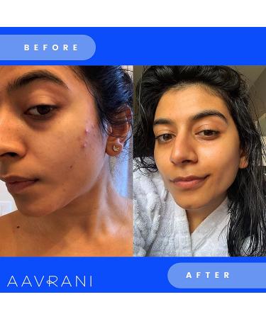 AAVRANI Glow Activating Exfoliator - Turmeric Face Mask with Raw Honey, Jojoba, and Neem - Clay Mask for Acne & Dark Spots - 3.4 Fl Oz - Buy Online on SooperMarket.com