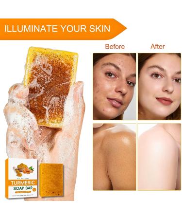 Turmeric Kojic Acid Soap Turmeric Soap Nature Turmeric Soap Dark Spot Corrector Pure Turmeric Handmade Soap Bar For Face & Body Moisturizing Erase Fine Lines Friendly Vegan&Cruelty Free - Buy Online on SooperMarket.com