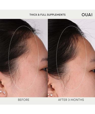 OUAI Scalp Serum + Thick & Full Hair Supplements - Solution for Thinning Hair - Buy Online on SooperMarket.com