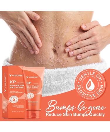KP Bump Eraser Body Scrub - Exfoliating Strawberry Legs Treatment for Women & Men - 8.45oz - Buy Online on SooperMarket.com