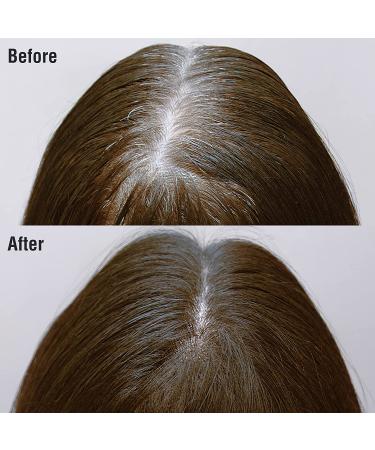 Kiss Root Cover Up Gray Concealer Spray 2 PACK (Medium Brown) - Temporary Hair Color Root Touch Up Dye 2.82 oz - Buy Online on SooperMarket.com