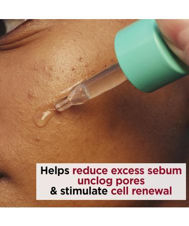 Clarins My Clarins PURE-RESET Resurfacing Blemish Serum 30ml - Buy Online on SooperMarket.com
