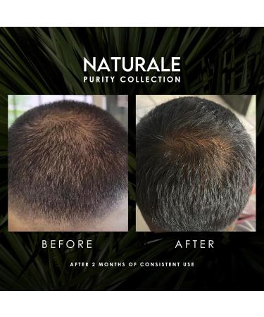 Naturale Shampoo for Thinning Hair - All-Natural Physician-Formulated Blend with Saw Palmetto & Essential Nutrients - 200 ML - Buy Online on SooperMarket.com