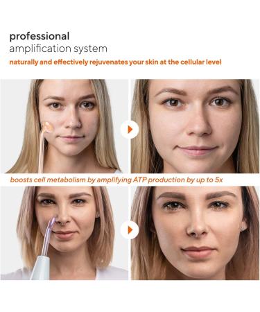 NuDerma Professional Skin Therapy Wand - Portable High Frequency Machine with 6 Wands for Clear, Firm, and Tight Skin - Buy Online on SooperMarket.com