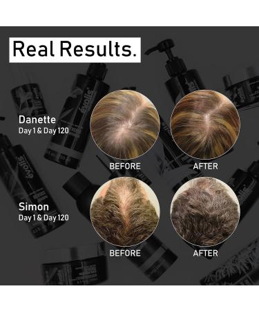 évolis Prevent Anti-Aging Shampoo | Natural Hair Loss Treatment for Men & Women | Sensitive Dry Scalp & Oily Hair Solution - 8.5 fl oz - Buy Online on SooperMarket.com