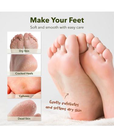 PURDERM Shiny & Soft Foot Peeling Mask (6 Pack) - Exfoliating Treatment for Cracked, Dry, Callused Feet - Removes Dead Skin & Reveals Baby Soft, Smooth Skin - Lemon & Natural Botanical Extracts - Buy Online on SooperMarket.com