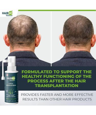 HairMD Transplant Clinical Repair Serum - 60ml Hair Regrowth Serum | Prevents Hair Loss, Stimulates New Growth | Fast & Effective Formula - Buy Online on SooperMarket.com
