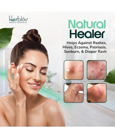 Beef Tallow Balm - Natural Grass Fed Whipped Tallow & Honey - Moisturizing All-Purpose Lotion for Eczema Dry Skin & Irritation - Made in USA - Buy Online on SooperMarket.com