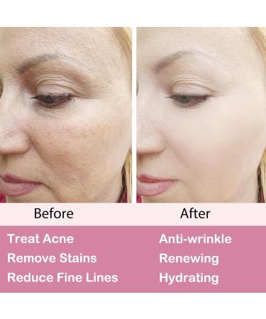 Retinol Moisturizer Cream For Face&Eye Area Anti Aging Wrinkles & Acne & Fine Lines with Vitamin E&Hyaluronic Acid & Jojoba Oil.Best Night&Day Facial Cream.With 2.5% Active Retinol (50Milliliter) - Buy Online on SooperMarket.com
