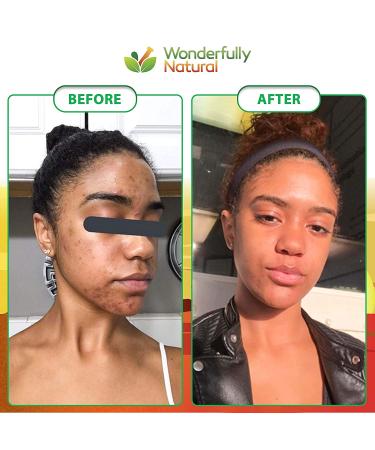 Organic African Black Soap 1lb Bar for Acne & Dark Spots | Face & Body Treatment | 60-Day Guarantee - Buy Online on SooperMarket.com
