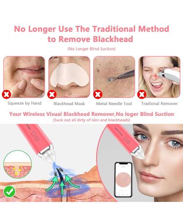 WiFi Blackhead Remover Pore Vacuum with 5.0 Megapixels HD Camera | Electric Blackhead Suction Tool with 6 Suction Heads | USB Rechargeable Pimple Acne Comedone Extractor Kit - Pink - Buy Online on SooperMarket.com