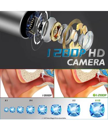 Wireless Earwax Otoscope with Charging Station and 14 Cleaning Tools | 3M High-definition Camera | 3-level LEDs | for iOS & Android - Buy Online on SooperMarket.com