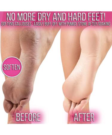 Jelly Pedicure Foot Soak for Dry Cracked Feet - Moisturizing Spa Pedi Soak with Damascus Rose - Foot Bath Salts for Relaxation - Foot Gel for Sore Feet - Buy Online on SooperMarket.com