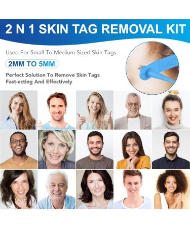 Skin Tag Remover Kit - Painless 2-in-1 Device for Medium to Large Skin Tags (2mm-7mm) - Mole Wart Removal Tool for Women and Men - Buy Online on SooperMarket.com