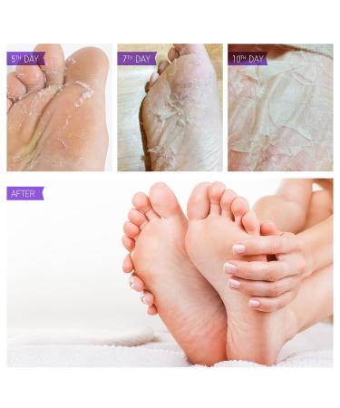 Foot Peel Mask for Exfoliating Calloused Heels - Deep Skin Treatment for Soft and Smooth Feet - Men and Women - Buy Online on SooperMarket.com