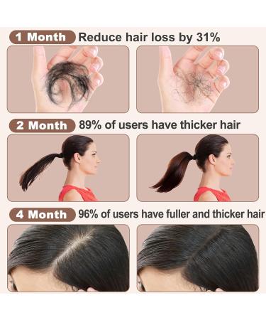 GoldWorld Rosemary Oil for Hair Growth w/Derma Roller Hair Growth Men Women 100ml Light-Weight Non-Greasy Hair Growth Oil Serum Reduce Beard Hair Loss Diluted Rosemary Oil Dry Damaged Hair Tonic - Buy Online on SooperMarket.com