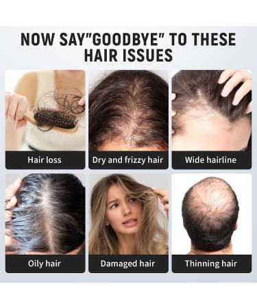 Laser Comb Hair Growth Device Medical Grade Lasers FDA Cleared Hair Loss Treatment for Men and Women with Thinning Hair Rechargeable Hair Growth Product Black - Buy Online on SooperMarket.com