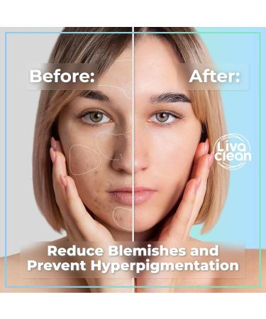 LivaClean Hydrocolloid Face Mask - 15 CT Pore & Chin Zit Patches | Large Hydrocolloid Pimple Patch Strips for Acne Care - Buy Online on SooperMarket.com