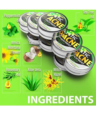 Cystic Acne Treatment & Scar Remover - USA Made Severe Acne Cleanser with Tea Tree Oil - Prevent Breakouts - Natural Pimple Cream - Buy Online on SooperMarket.com