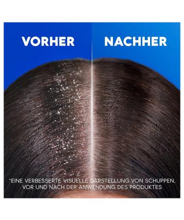 Head & Shoulders Itchy Scalp Anti-Scales Shampoo 500ml - Up to 100% Dandruff Protection | International Shipping - Buy Online on SooperMarket.com